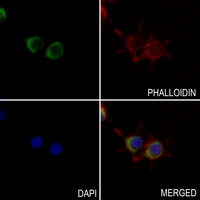 3 - Anti-P2X1 Antibody AP51813
