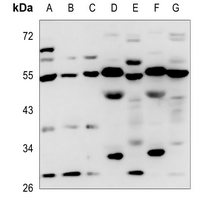 1 - Anti-P2X1 Antibody AP51813