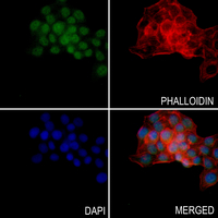 3 - Anti-N4BP2L2 Antibody AP51818