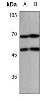 1 - Anti-N4BP2L2 Antibody AP51818