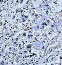 19 - Anti-Kv1.5 Antibody AP51820