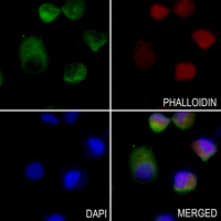 3 - Anti-Pyruvate Carboxylase Antibody AP51826