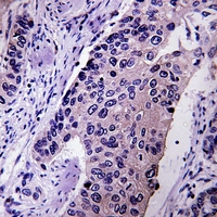 19 - Anti-Pyruvate Carboxylase Antibody AP51826