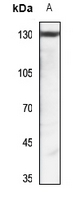 1 - Anti-Pyruvate Carboxylase Antibody AP51826