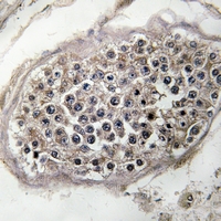 19 - Anti-RAB3GAP1 Antibody AP51827