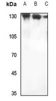 1 - Anti-RAB3GAP1 Antibody AP51827