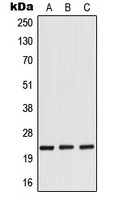 1 - Anti-RANBP1 Antibody AP51830