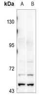 1 - Anti-GFR Antibody AP51832
