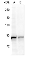 1 - Anti-RIN1 Antibody AP51833