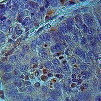 19 - Anti-RASSF2 Antibody AP51834