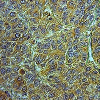 19 - Anti-RASA3 Antibody AP51835