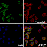 3 - Anti-RAB23 Antibody AP51837