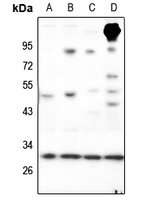 1 - Anti-RAB23 Antibody AP51837