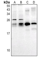 1 - Anti-RAB30 Antibody AP51838