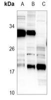 1 - Anti-RAB31 Antibody AP51839
