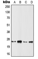 1 - Anti-RRAS2 Antibody AP51840