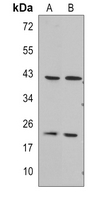 1 - Anti-RGS5 Antibody AP51842