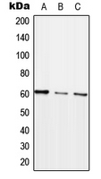 1 - Anti-ARHGEF5 Antibody AP51843