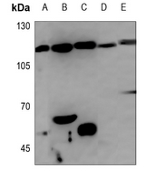 1 - Anti-GEF H1 Antibody AP51844