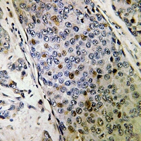 19 - Anti-URI1 Antibody AP51846