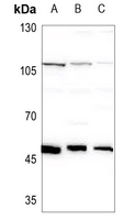 1 - Anti-RBM34 Antibody AP51849