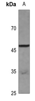 1 - Anti-Septin 6 Antibody AP51851