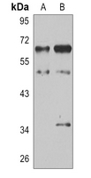 1 - Anti-MST2 Antibody AP51852