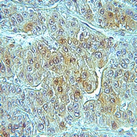 19 - Anti-RIOK3 Antibody AP51853
