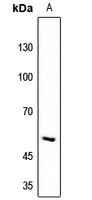 1 - Anti-RIOK3 Antibody AP51853