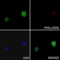 3 - Anti-TLK1 Antibody AP51854