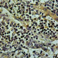 19 - Anti-TLK1 Antibody AP51854