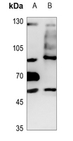 1 - Anti-TLK1 Antibody AP51854