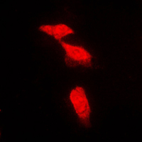 3 - Anti-PPP2R5A Antibody AP51855