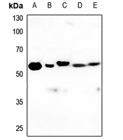 1 - Anti-PPP2R5A Antibody AP51855