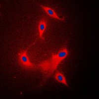 3 - Anti-PPP2R1B Antibody AP51856
