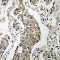 19 - Anti-PPP2R1B Antibody AP51856