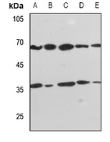 1 - Anti-PPP2R1B Antibody AP51856