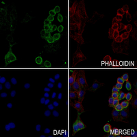 3 - Anti-SLC6A8 Antibody AP51857