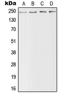 1 - Anti-Nav1.4 Antibody AP51859