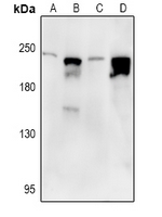1 - Anti-Nav1.7 Antibody AP51860