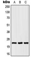 1 - Anti-SCN2B Antibody AP51861