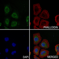 3 - Anti-SGLT2 Antibody AP51862