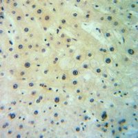 19 - Anti-SGLT2 Antibody AP51862