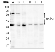 1 - Anti-SGLT2 Antibody AP51862