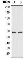 1 - Anti-GLUT2 Antibody AP51867