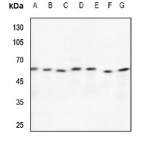 1 - Anti-TCP1 theta Antibody AP51872