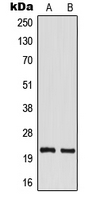 1 - Anti-TM2D1 Antibody AP51874