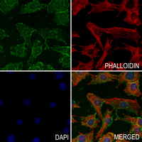 3 - Anti-ATP6V1B1 Antibody AP51878