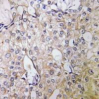 19 - Anti-ATP6V1B1 Antibody AP51878