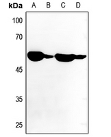 1 - Anti-ATP6V1B1 Antibody AP51878